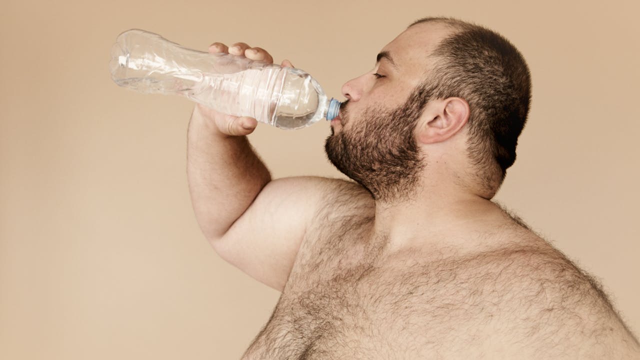 obesidad hombre
